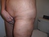 this where you can see it better what I'm talking about, you can see where my tights were, I'm deform now :(