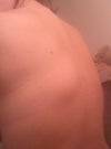 It's about 4 inches. It's visible through a t-shirt. It's grown slowly but I don't want it to keep getting bigger!