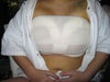 Day of surgery
