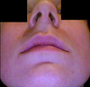Nostrils