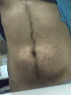 The upper portion is fine, but you can see the lump in the middle