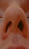 septum