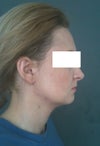 side2-me-now