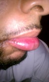 lip