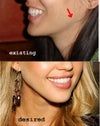 my jawline and comparison to desired jawline
