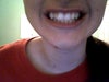 my teeth