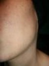 get treatment for my rough skin texture