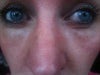 close up of my flat/puffy eyes