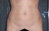 Before any lipo