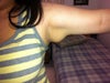 left arm