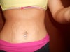 Stretch marks, doesn't show the real MESS