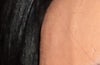 running down right eyebrow