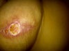 this is just under the nipple helllp :(