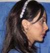 right side