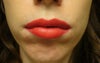 Chin puckering.