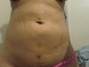 This is how I look now front view lumpy and embarassing (I wanted a flat even stomach)