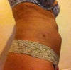 This is current side view no changes since week 4 I am at week 8
