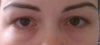 My eyes 