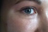 Right eyelid
