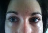 Both eyes front on