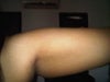 upper arm