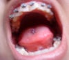mouth open