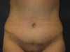 I dont have room to attach the befores of these people, but I feel as if they have comparable bodies to myself