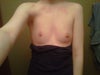 The volume of the one breast looks worse here, although there is a difference.