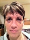 Another After