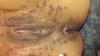 A few hours following initial treatment