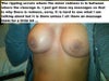 I did my best to show the cleavage rippling, like I stated on the picture the redness is from me massaging them right before the pic.