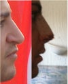 Left:Before
Right:After