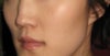 dip in my nose