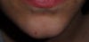 Chin