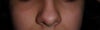 Nose + Cheek