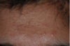 Forehead