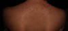 Back (note skin color : olive tone Mediterranean )