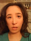 other front facial