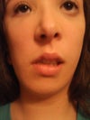 front facial