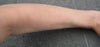 top of left arm