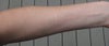left arm