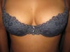 Front close-up