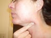 Not much fat directly under chin. Doesn't seem to be able to be pulled back very far...