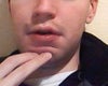 Can my lip be made to move up in this direction?