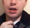 My lips at rest, showing my bottom lip.
