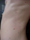 waist, pink spots look larger than original spot...