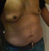Stomach and chest front