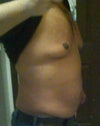 Stomach and chest side