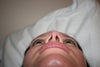 nostrils are not symetric