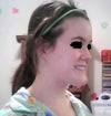Taken at a semi-side angle where I feel features are most prominent/uncomplimentary.